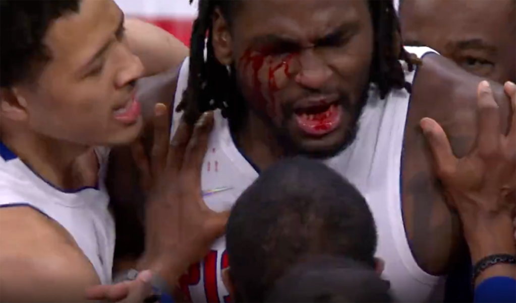 lebron-james-nba-pistons-bloody-fight.png