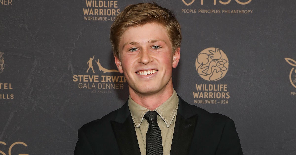 Robert Irwin Gets Bitten in Face by Same Snake Species as Late Dad ...