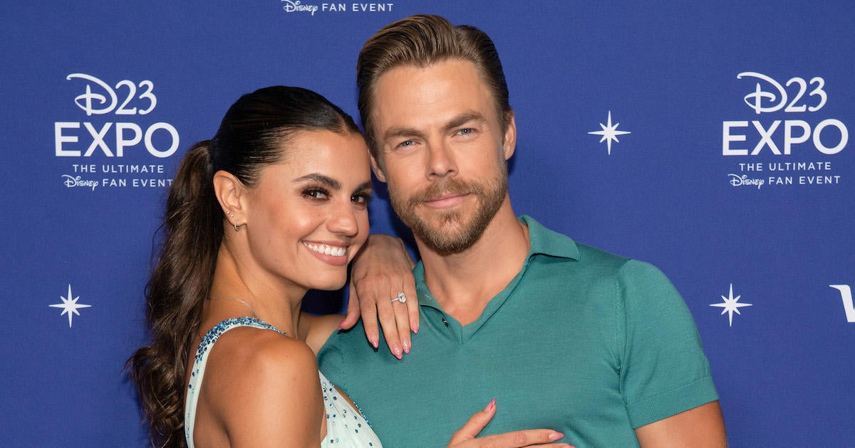 Derek Hough's Wife Hayley Erbert Speaks Out in Tearful Video After(02)