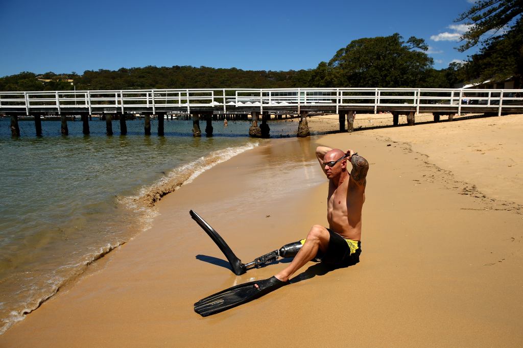 Shark Attack Survivor Motivates Others To Overcome Adversity