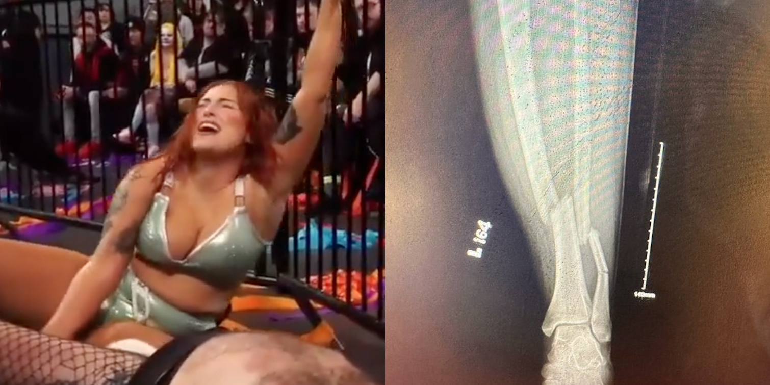 Pro Wrestler ‘Snapped Her Leg’ During Dive Outside Ring: GoFundMe Launched to Support Allie Katch