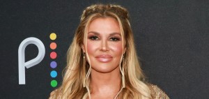 Brandi Glanville’s Facial Disfigurement Is Affecting Her Teeth