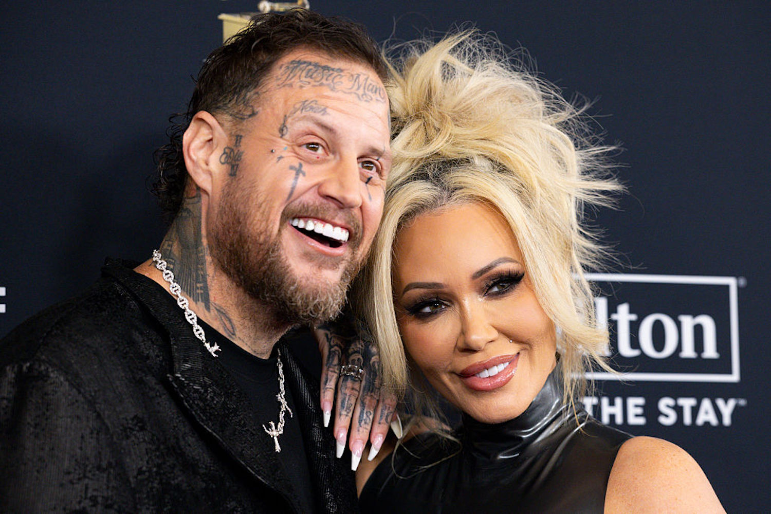 Jelly Roll's Wife, Bunnie Xo, Reveals 'Horrific' Side Effect From